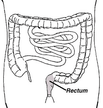 Line Drawing of the Rectum Location in the Colon